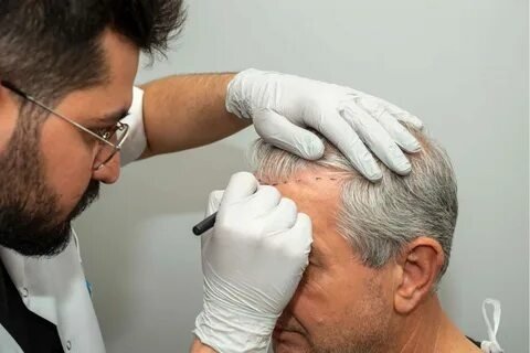 Dark Spot Treatment Options for Healthier and More Even-Looking Skin