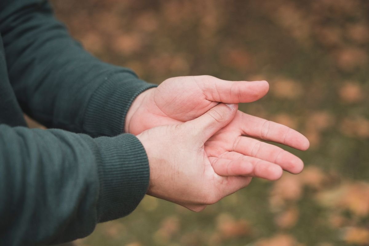 Non-Surgical Dupuytren’s Treatment: Supporting Hand Mobility Without Surgery