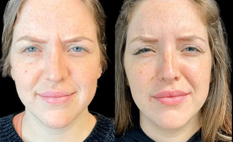 Best Aesthetic Clinics in Dubai for Botox: How to Find Qualified Practitioners