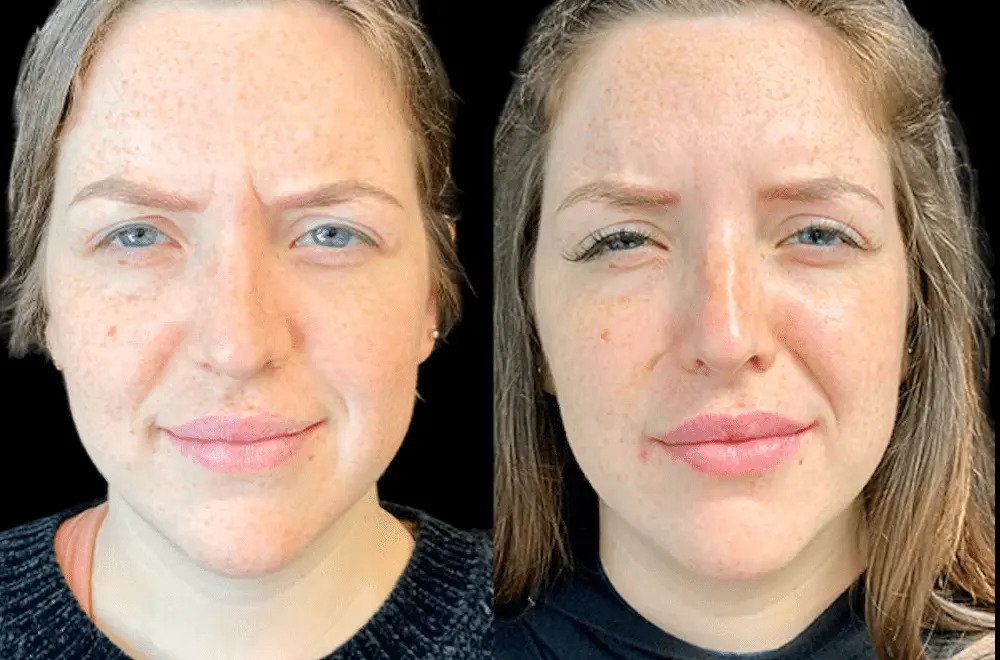 Best Aesthetic Clinics in Dubai for Botox: How to Find Qualified Practitioners