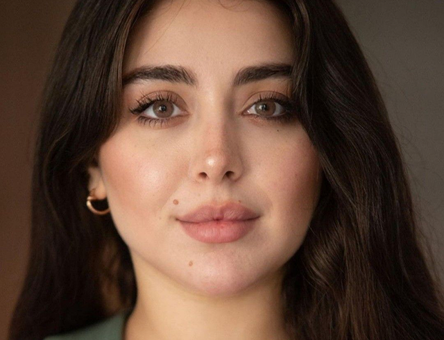 Lip Fillers in Viera, FL: A Guide to Natural-Looking Lip Enhancement