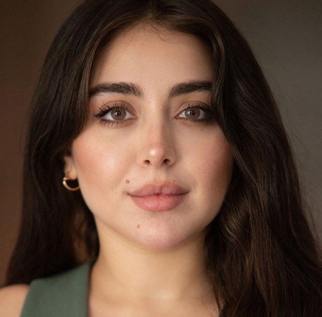 Lip Fillers in Viera, FL: A Guide to Natural-Looking Lip Enhancement