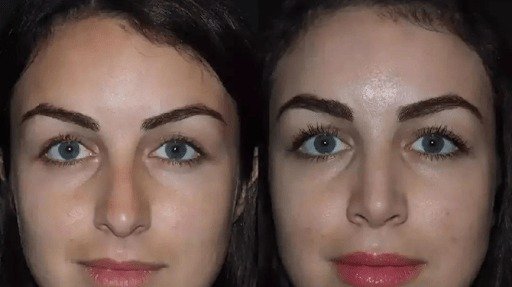Best Rhinoplasty Surgeon in Dubai: Essential Consultation Questions