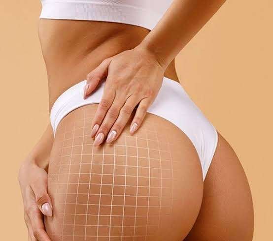 Butt Fillers in Dubai: Enhance Your Curves With Fillers
