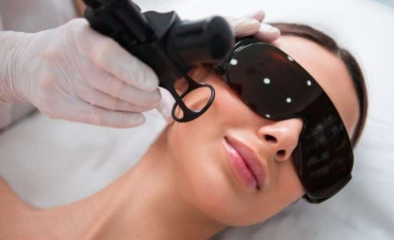 Fractional Laser Treatment in Dubai: What to Expect During the Treatment Process