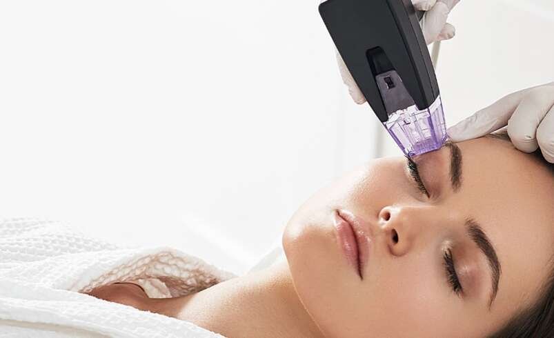 Morpheus8 in Dubai: How Does Radiofrequency Microneedling Work?