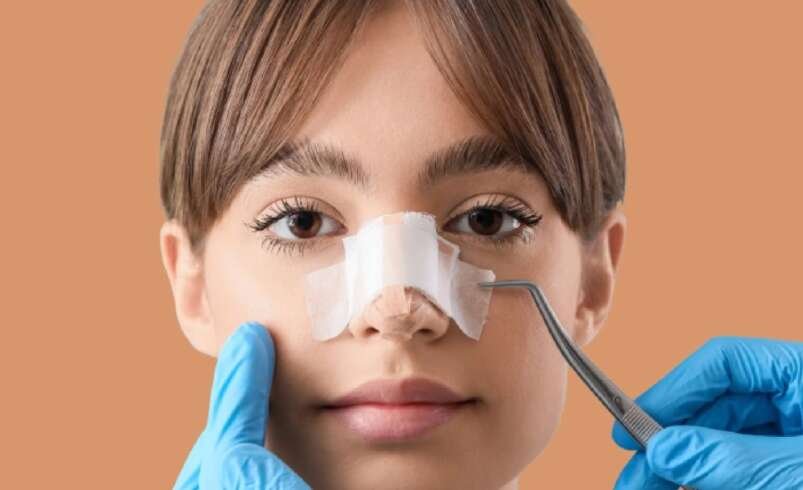 Septoplasty in Dubai: Long-Term Results and Recovery