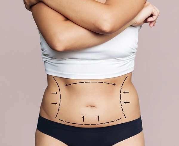 Best Tummy Tuck Surgeon in Dubai: What Is Evaluated During the Initial Consultation?